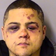 Illustration for article titled This Is What Happens To Your Face When You Try To Rob An MMA Expert